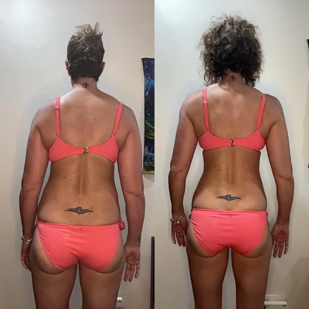 Chantel transformation back