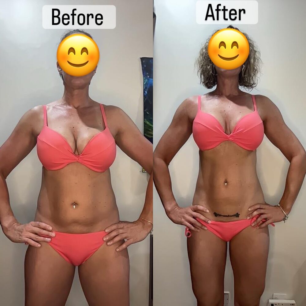 Chantel transformation front