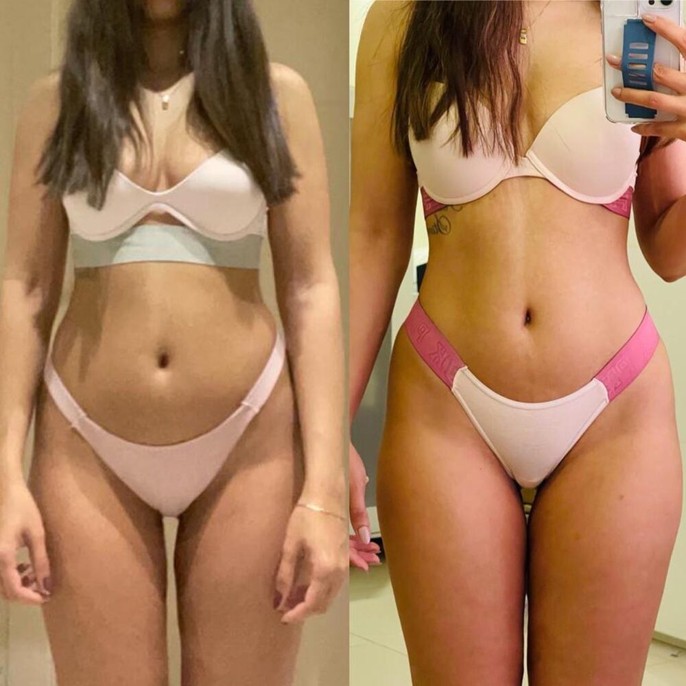 Zara transformation front